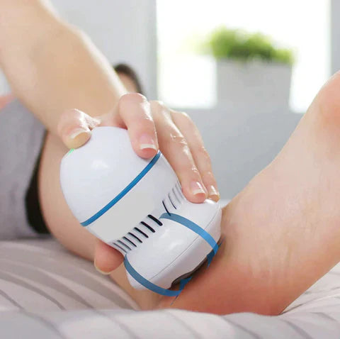 Electric Vacuum Callus Remover