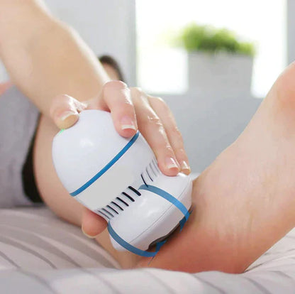 Electric Vacuum Callus Remover